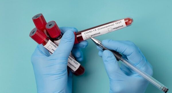 Top 10 best blood units in London
