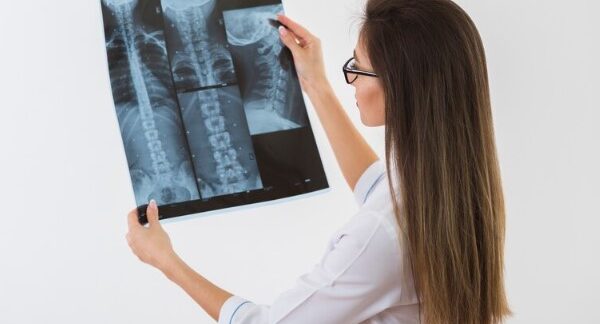 Top 10 best osteoporosis clinics in London